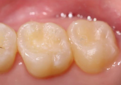 温州雅乐口腔详细的预约挂号方式及流程