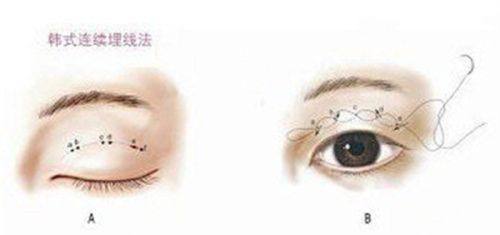 上海光博士医疗美容诊所是正规医院吗?