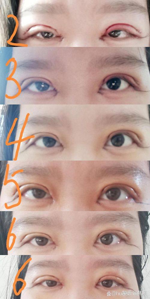 广西医 科 大学第一附属医院整形美容外科真人口碑评价怎么样？