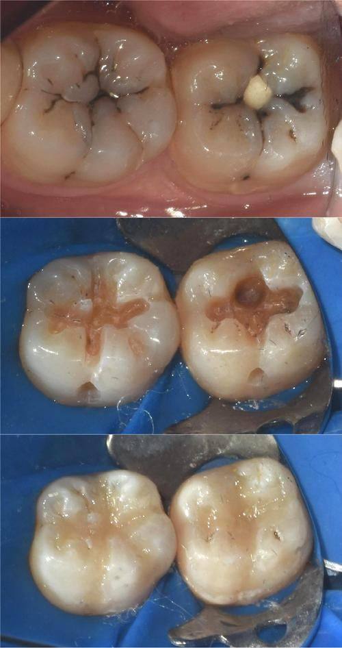 深圳鸿源口腔诊所是正规医院吗?