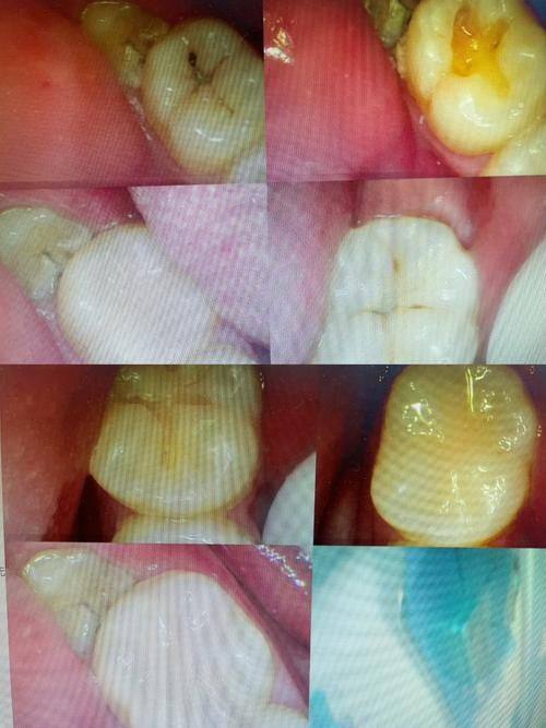 黔南州中医医院口腔中 心医生团队实力强大及骨干医生简介