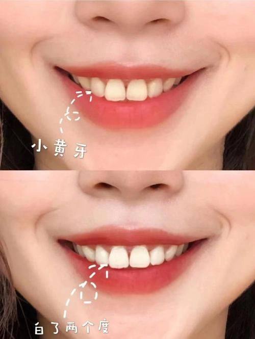 浙江温州永嘉何凯口腔诊所真人口碑评价怎么样？