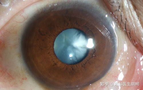 达州市中 心医院眼科收费价格表/收费标准