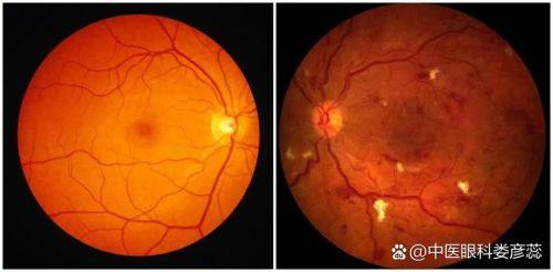 广西壮族自治区妇幼保健院眼科是正规医院吗？