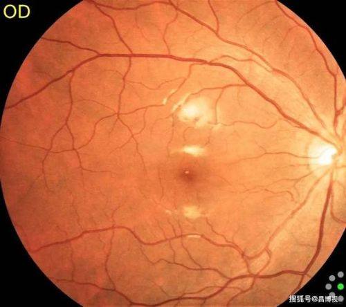 达州市中 心医院眼科真人口碑评价怎么样?