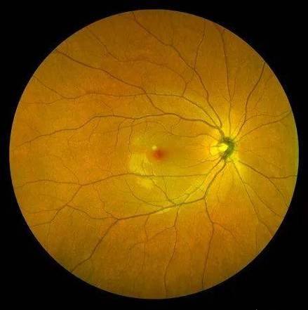 广西壮族自治区妇幼保健院眼科真人口碑评价怎么样？