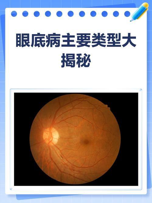 达州市中 心医院眼科详细的预约挂号方式及流程