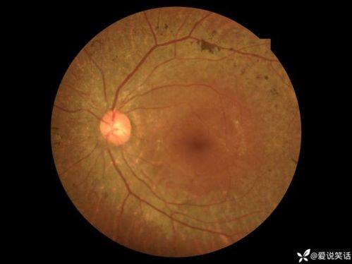 广西壮族自治区妇幼保健院眼科详细的预约挂号方式及流程