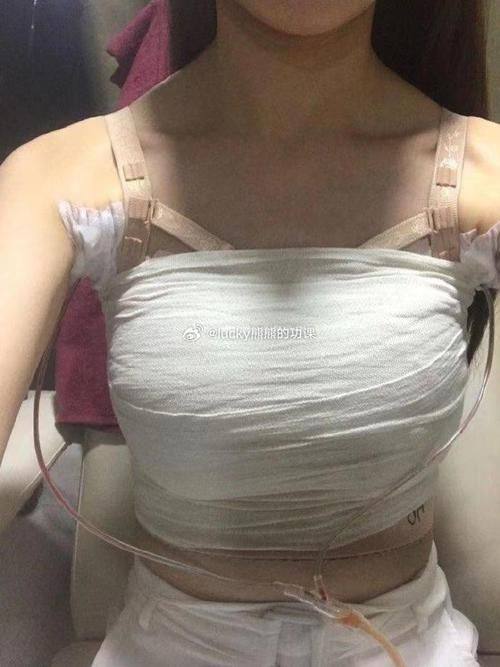 广西医 科 大学第一附属医院整形美容外科详细的预约挂号方式及流程