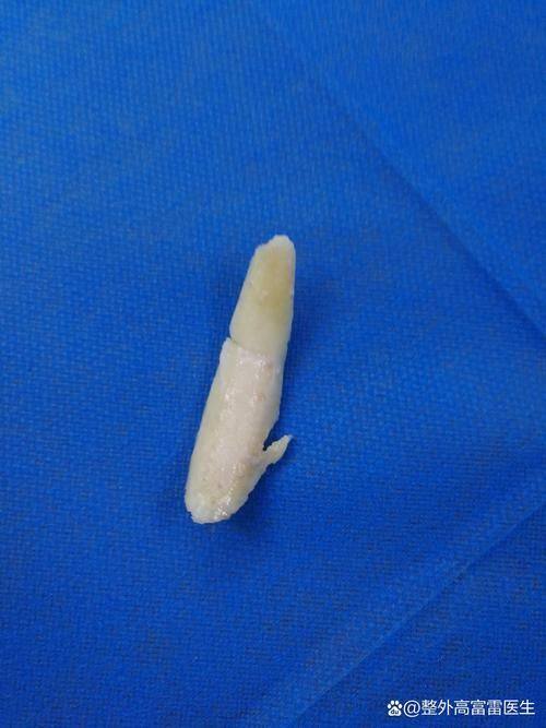 贵港市人民医院烧伤整形外科详细的预约挂号方式及流程