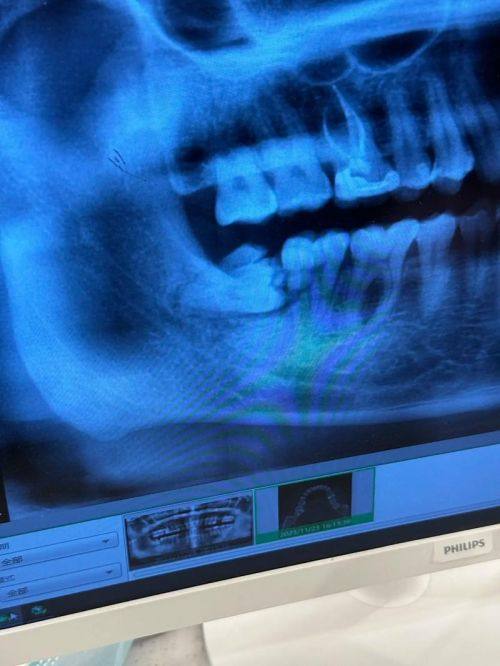 湖南常德汉寿博又爱口腔特色项目及技术优势