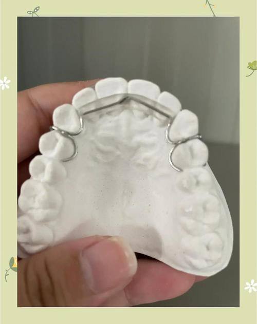 浙江温州永嘉何凯口腔诊所特色项目及技术优势