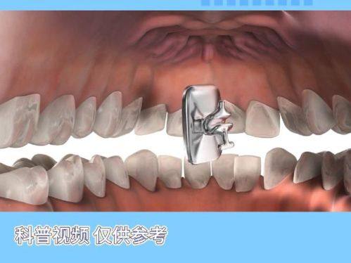 浙江温州永嘉何凯口腔诊所地址电话营业时间