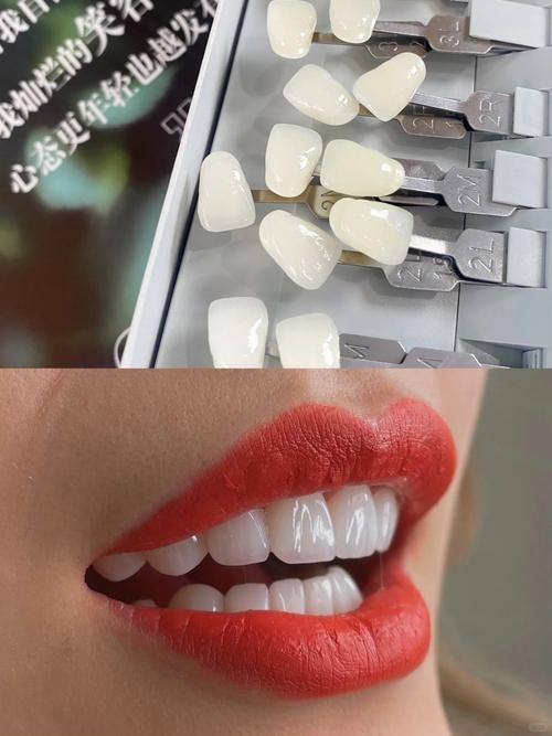 长沙明康口腔特色项目及技术优势