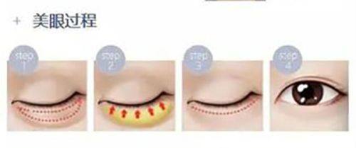 宁波皮肤病专科医院真人口碑评价怎么样？