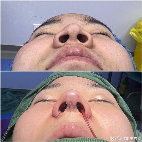 鄂州逆时光医疗美容医院真人口碑评价怎么样？