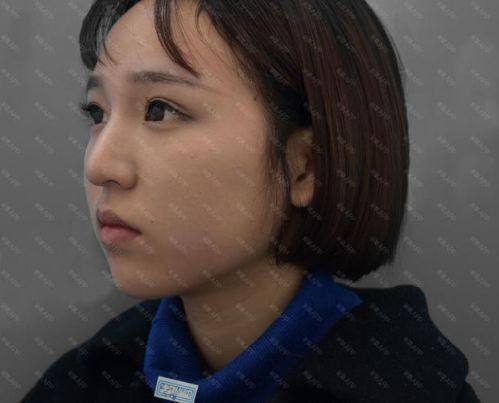 大庆孙显志微创医疗整形美容详细的预约挂号方式及流程