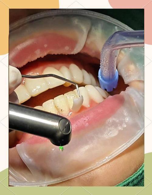 江西省人民医院口腔一科收费价格表/收费标准