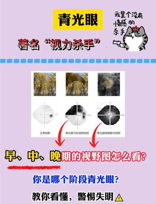 宣汉县人民医院眼科是正规医院吗？