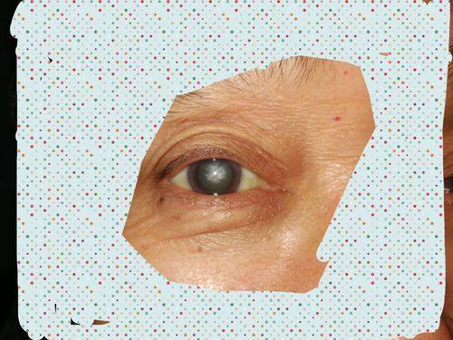 宣汉县人民医院眼科真人口碑评价怎么样？