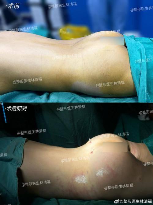 大庆孙显志微创医疗整形美容真人口碑评价怎么样?