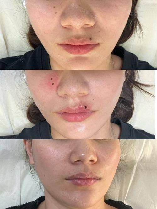 石家庄张小熊医疗美容诊所真人口碑评价怎么样？