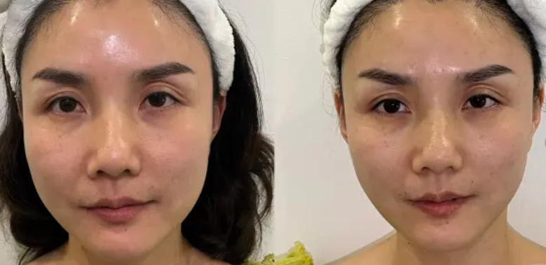 宁波皮肤病专科医院特色项目及技术优势