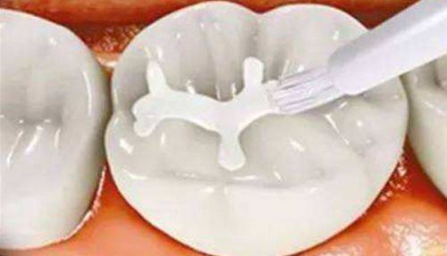 深圳尔睦口腔收费价格表/收费标准