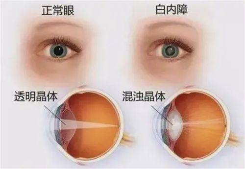 秦皇岛军工医院眼科详细的预约挂号方式及流程