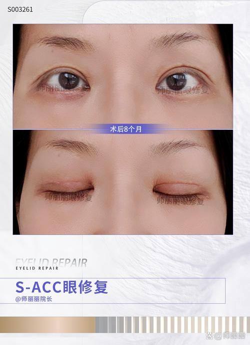 成都睿东上善医疗美容诊所特色项目及技术优势