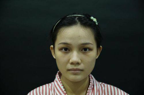 河北医 科 大学第二医院(整形外科)真人口碑评价怎么样？