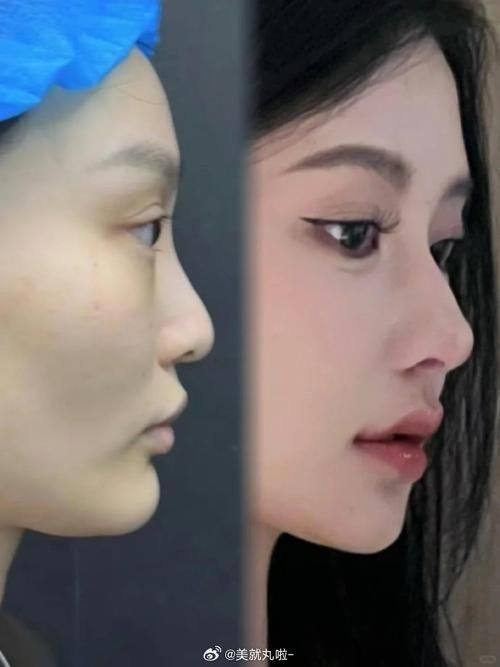 大连星范医疗整形美容真人口碑评价怎么样？