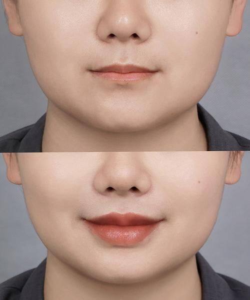 温州极丽整形地址电话营业时间