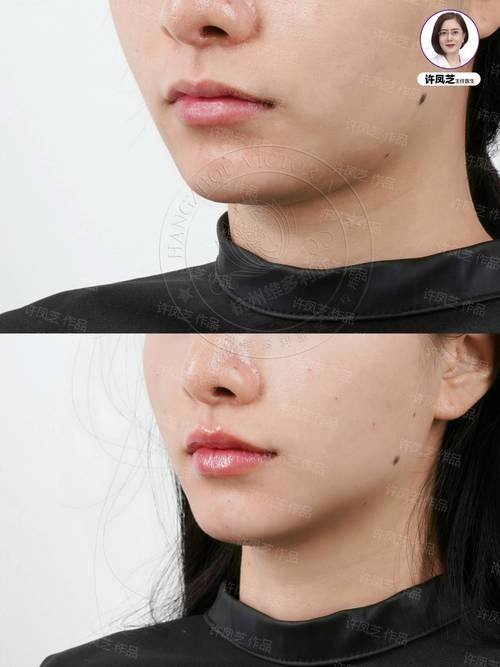 成都睿东上善医疗美容诊所收费价格表/收费标准