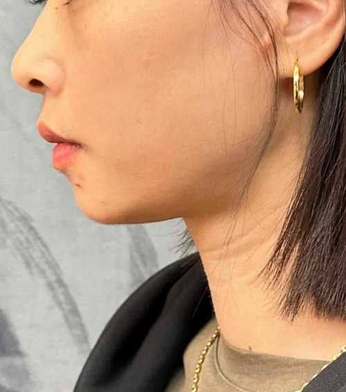 扬州市中医院医学美容科是正规医院吗？