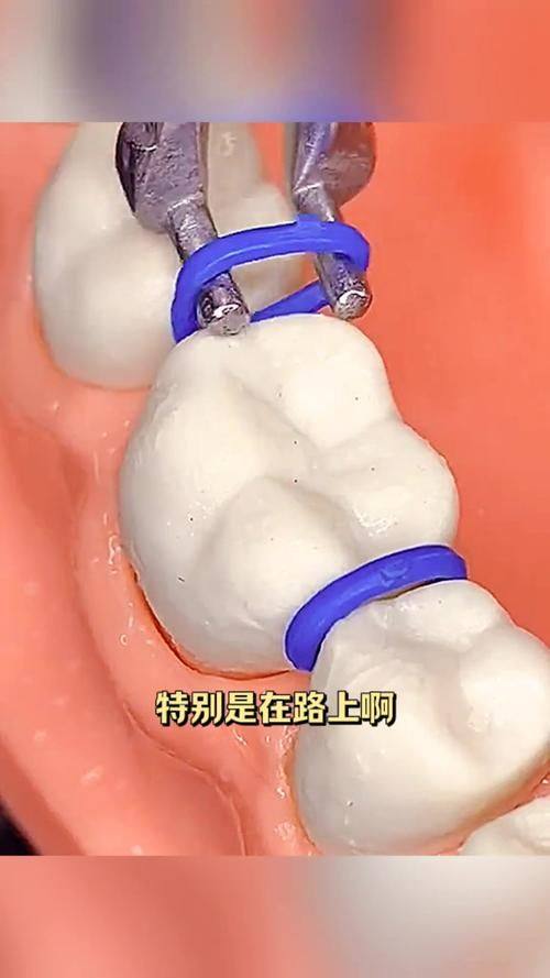 重庆合川吉美口腔收费价格表/收费标准