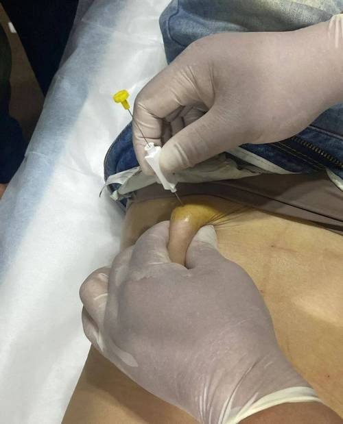 韩国dressps整形外科特色项目及技术优势