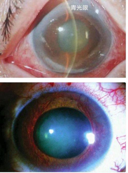 河北省儿童医院眼科医生团队实力强大及骨干医生简介