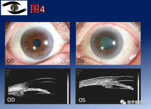 毕节明仁眼科医院特色项目及技术优势