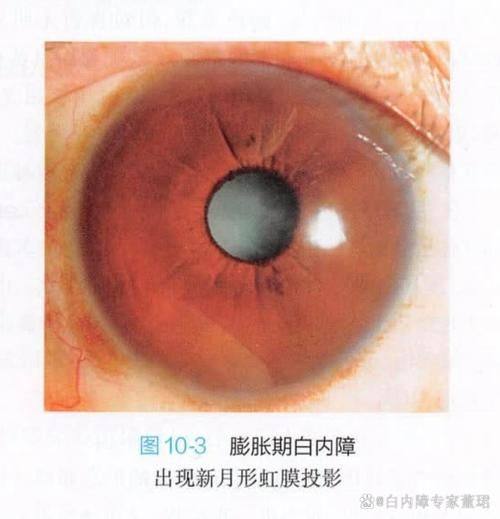 河北省儿童医院眼科详细的预约挂号方式及流程