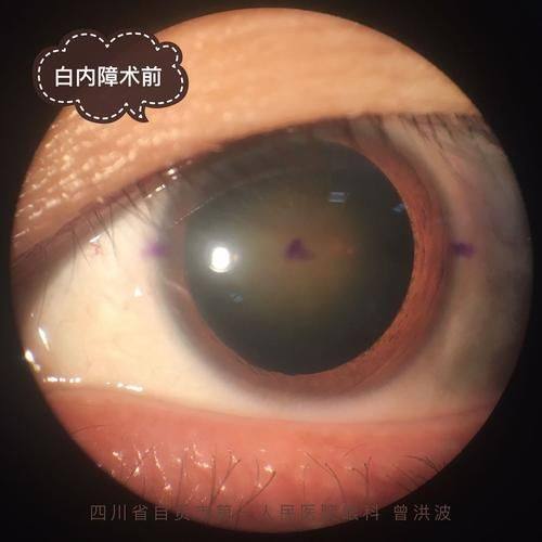 毕节明仁眼科医院是正规医院吗？