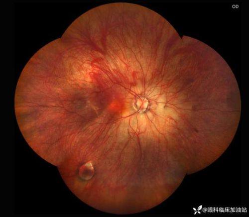 河北省儿童医院眼科特色项目及技术优势