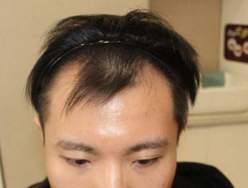 成都睿东上善医疗美容诊所真人口碑评价怎么样？