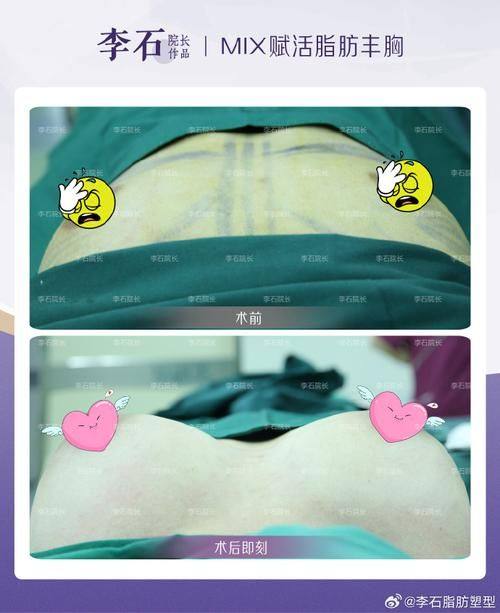 韩国dressps整形外科真人口碑评价怎么样？