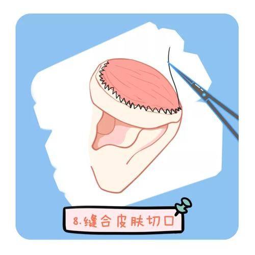 温州极丽整形收费价格表/收费标准