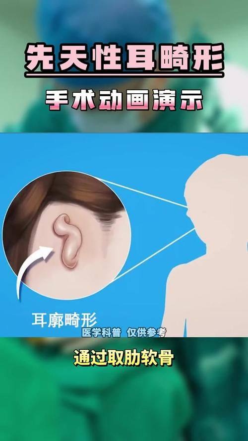 河北医 科 大学第二医院(整形外科)特色项目及技术优势