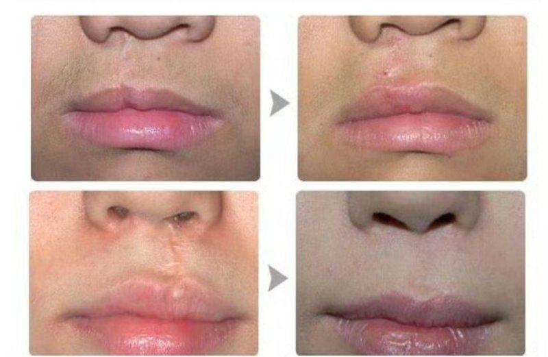 上海莱森医疗美容门诊部地址电话营业时间