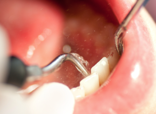 晋中市中医院口腔科特色项目及技术优势