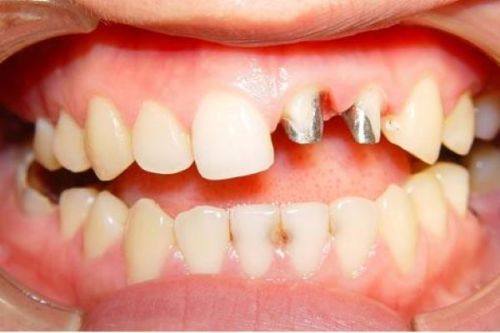 甘肃金昌张露口腔诊所真人口碑评价怎么样？