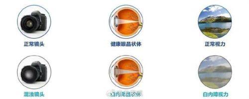 黄骅视光眼科医院特色项目及技术优势